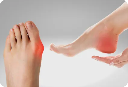 Deformaciones del pie